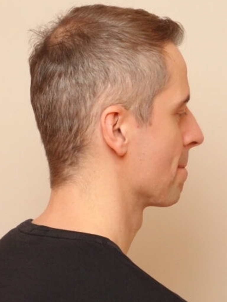 Image of model Daniel with khadi Dark Blonde Hair Color
